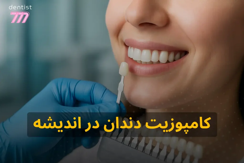 هزینه و قیمت کامپوزیت دندان در اندیشه 1405 ( + قسطی)