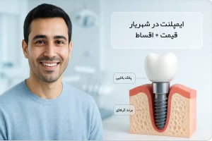 ایمپلنت دندان در شهریار